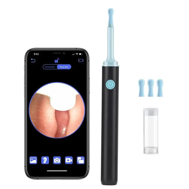 Smart Visual Ear Cleaner