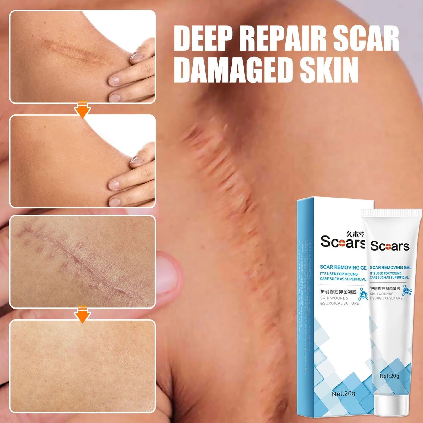 New Herbal Scar Repair Cream