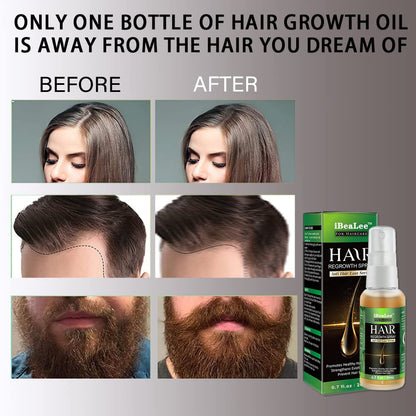 Ginger Hair Growth Spray